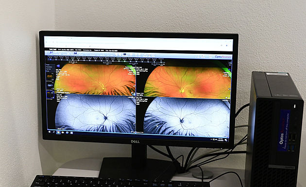 Šilhání i tupozrakost moravských dětí bude řešit nová oční klinika ve Vyškově